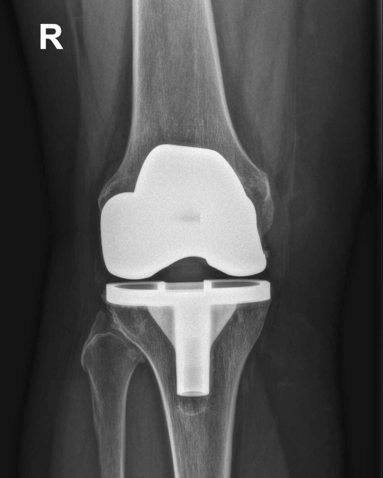 Knie Operation Orthop die Dr Radl knie-operation-orthop-die-dr-radl